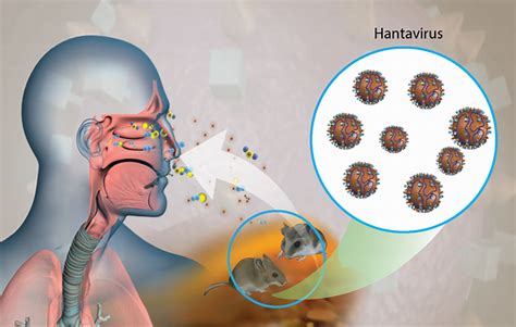 testing droppings for hantavirus|hantavirus infection treatments.